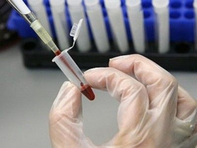На еженедельном IT-семинаре в Департаменте образования московская школьница представила изобретение для ускоренного анализа крови