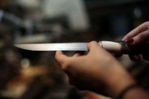 Пострадавший находится в больнице. Фото: Анна Иванцова
