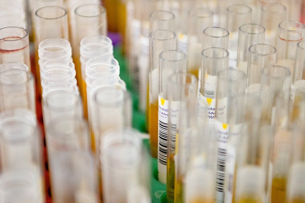 Москва привлекла частные лаборатории к проведению тестов на коронавирус