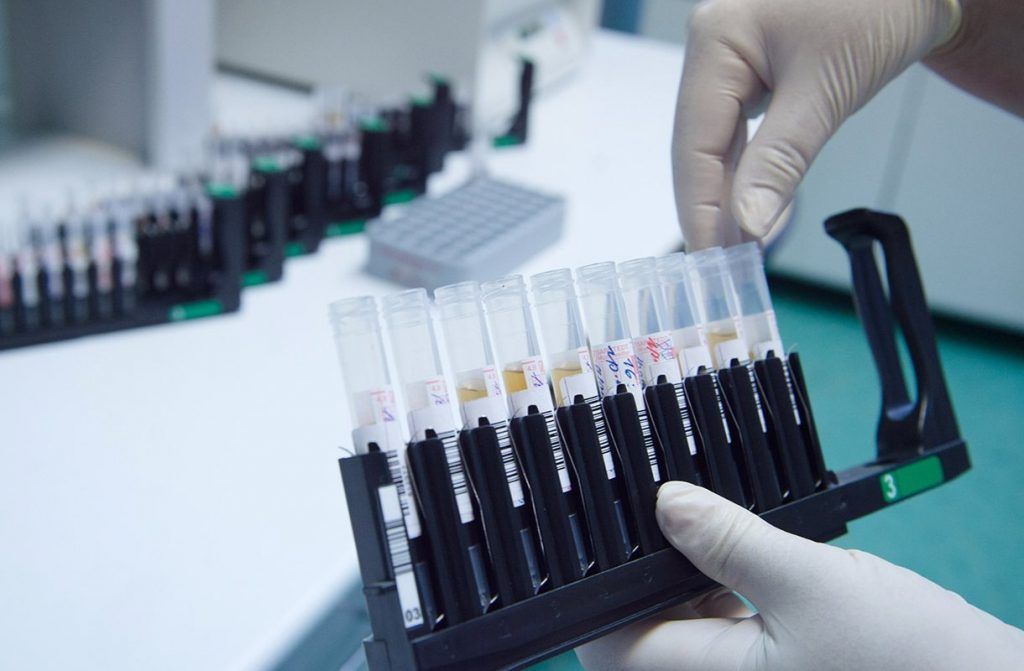 Эксперт отметил значение массового тестирования на антитела к COVID-19 для его исследования. Фото: сайт мэра Москвы