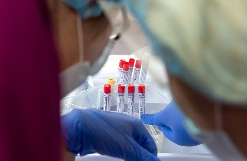 Уже около 2 тыс москвичей без очередей сдали тест на антитела к COVID-19. Фото: сайт мэра Москвы