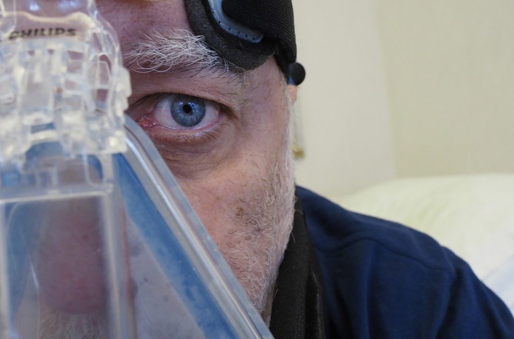 19 ноября 2020 года. Михаилу Геллеру пришлось провести много времени на аппарате искусственной вентиляции легких. Фото: Михаил Геллер